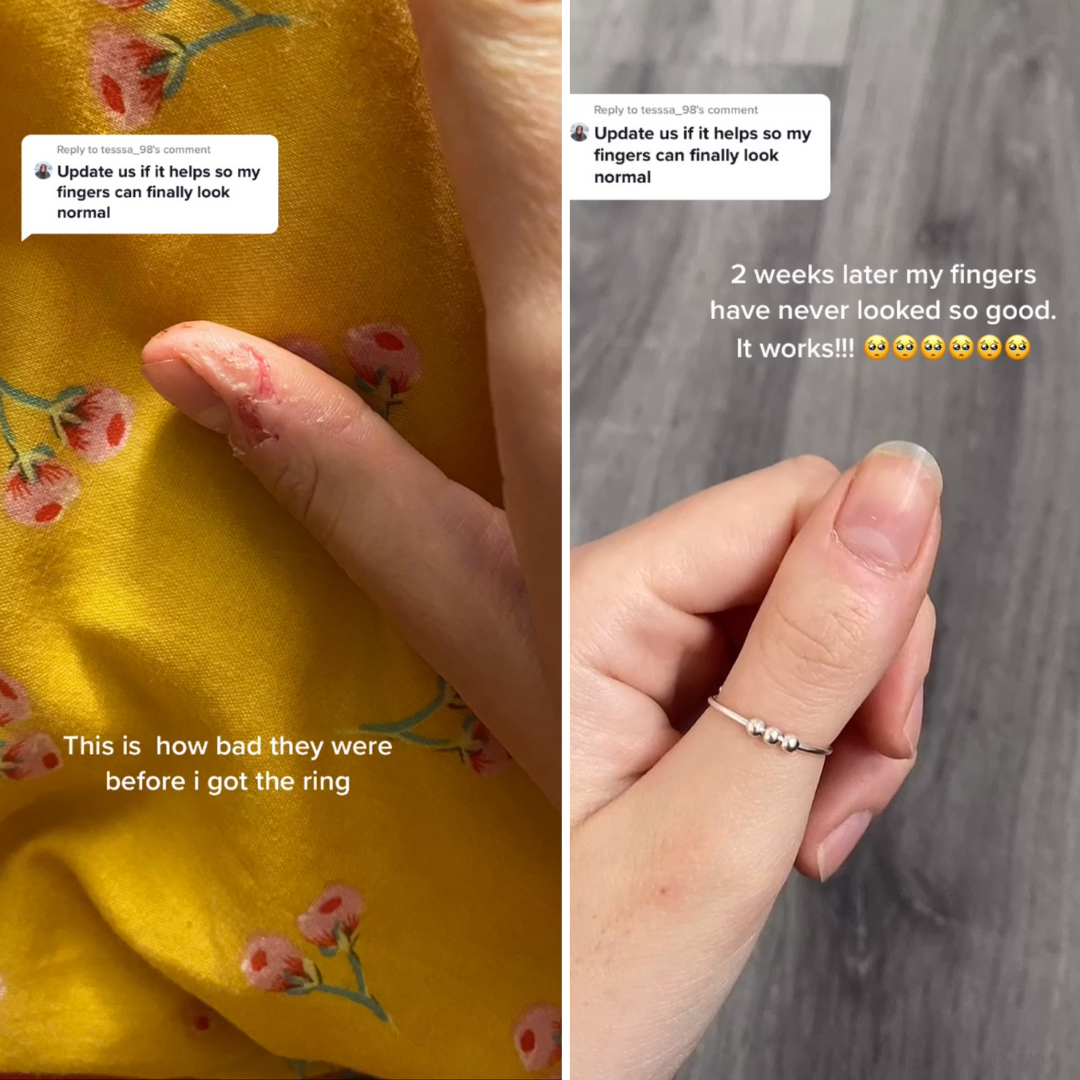 Before and after comparison of a person's fingers with a ring on a yellow fabric background.