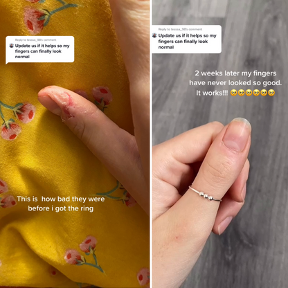 Before and after comparison of a person's fingers with a ring on a yellow fabric background.
